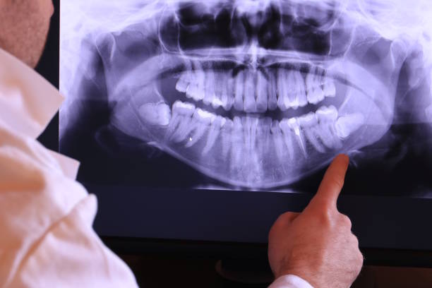Best Emergency Root Canal Therapy in Redland, TX