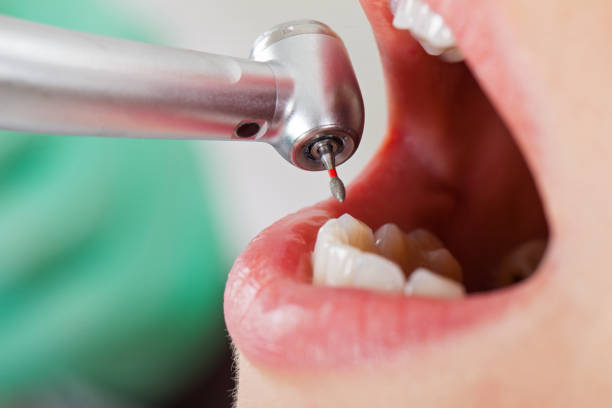 Best Emergency Treatment for Oral Infections in Redland, TX